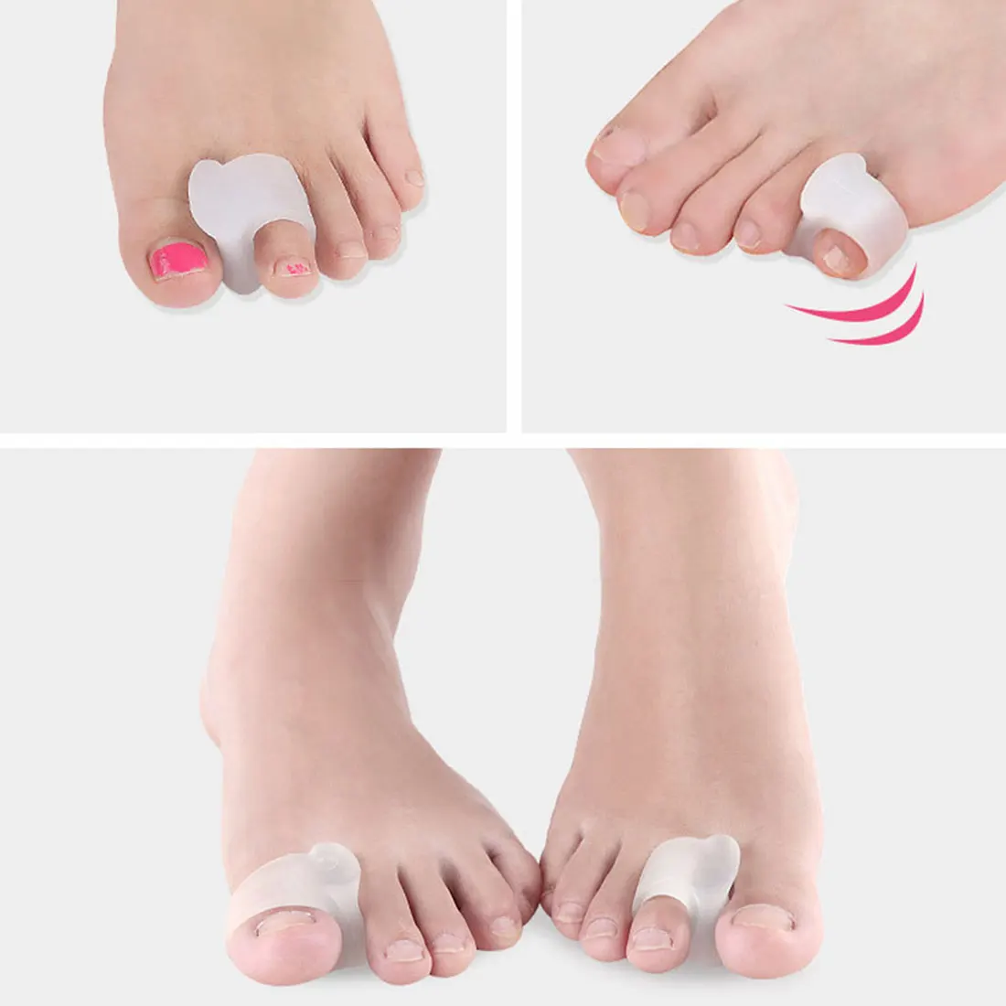 2 шт., силиконовые разделители для пальцев ног, при вальгусной деформации
2 шт., силиконовые разделители для пальцев ног, при вальгусной деформации
