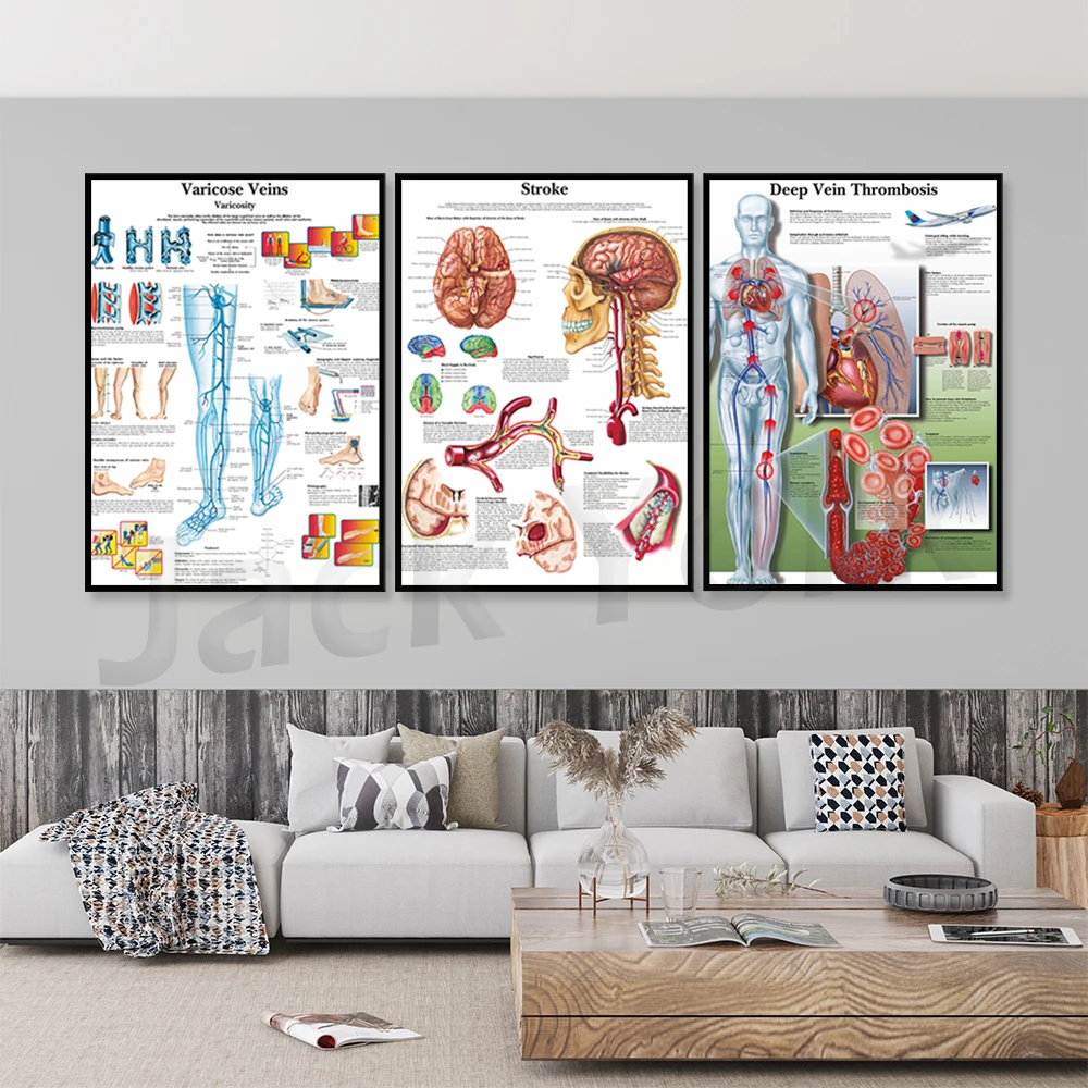 Human Anatomy Muscle System Poster Anatomy Diagram Human Medical Wall Art Photo Print Medical Education Office Decorative Mural
Human Anatomy Muscle System Poster Anatomy Diagram Human Medical Wall Art Photo Print Medical Education Office Decorative Mural