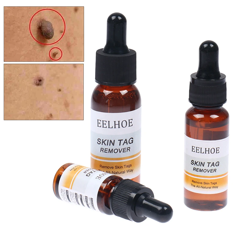 10/20/30ml Skin Tag Remover Mole Foot Corn Wart Care Treatment Pure Acid Essence 100% Essence Hyaluronic Serum Natural Oil
10/20/30ml Skin Tag Remover Mole Foot Corn Wart Care Treatment Pure Acid Essence 100% Essence Hyaluronic Serum Natural Oil