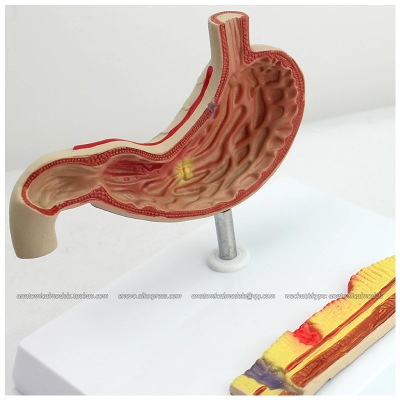 12534 / Human Stomach Disease Model Digestive System Model,Medical Science Educational Teaching Anatomical Models
12534 / Human Stomach Disease Model Digestive System Model,Medical Science Educational Teaching Anatomical Models