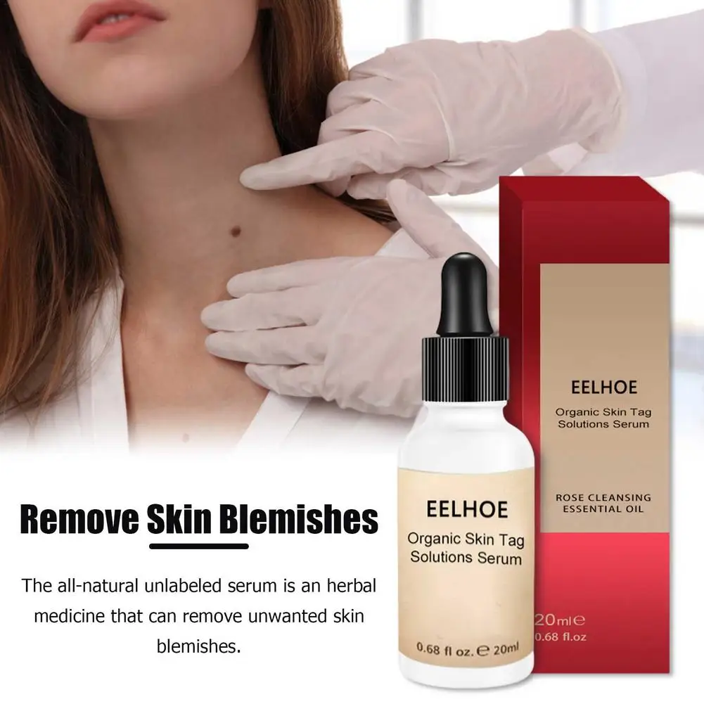 Organic Tags Remove Serum Mole Corrector Skin Tag Remover Dark Spot Purifying Serum Skin Lightening Mole Tag Removal Essences
Organic Tags Remove Serum Mole Corrector Skin Tag Remover Dark Spot Purifying Serum Skin Lightening Mole Tag Removal Essences