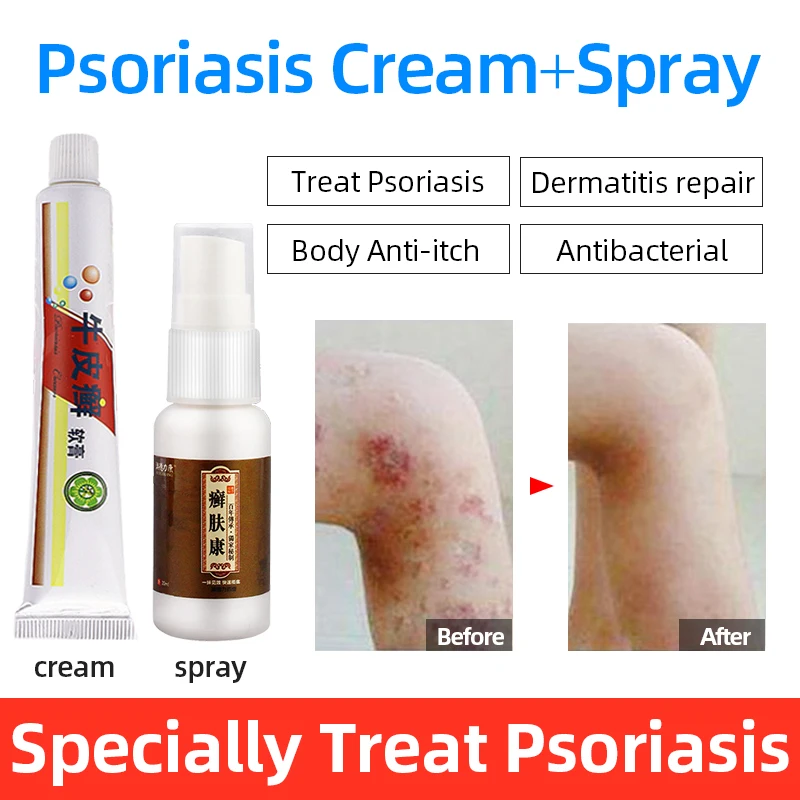 Natural Herbal Medicine Psoriasis Ointment Antibacterial Psoriasis Dermatitis Itching Repair Eczema Psoriasis Allergy Skin Cream
Natural Herbal Medicine Psoriasis Ointment Antibacterial Psoriasis Dermatitis Itching Repair Eczema Psoriasis Allergy Skin Cream