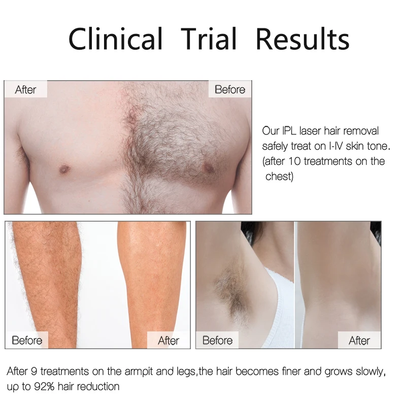 Househeld IPL Depilatory Laser Epilator Women Hair Shaver Permanent Hair Removal Whole Body Hair Remover (White EU Plug)
Househeld IPL Depilatory Laser Epilator Women Hair Shaver Permanent Hair Removal Whole Body Hair Remover (White EU Plug)