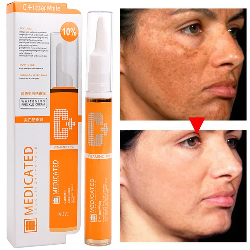 Гель для удаления веснушек с витамином C, искусственная мелазма, выцветающая пигментация, отбеливание ярче, сыворотка, жидкость для ухода за...
Гель для удаления веснушек с витамином C, искусственная мелазма, выцветающая пигментация, отбеливание ярче, сыворотка, жидкость для ухода за...