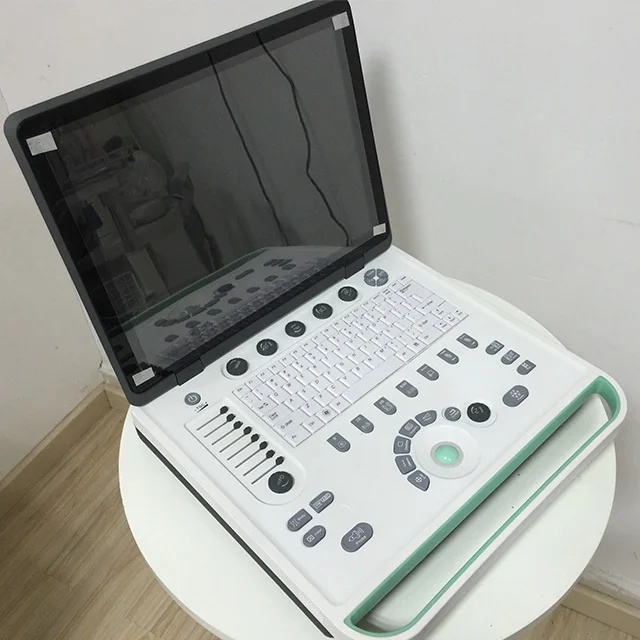 Sales Advanced configuration with one host/convex/probe aluminum trunk laptop body B ultrasound scanner
Sales Advanced configuration with one host/convex/probe aluminum trunk laptop body B ultrasound scanner