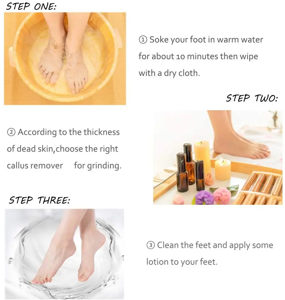 NEW Electric Foot File Pedicure Kit, USB Rechargeable Waterproof Hard Skin Remover with 3 Rollers and 2 Speeds, Foot Files Set
NEW Electric Foot File Pedicure Kit, USB Rechargeable Waterproof Hard Skin Remover with 3 Rollers and 2 Speeds, Foot Files Set