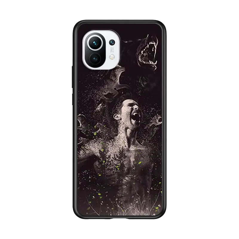 

Teen Wolf Dylan Obrien for Xiaomi Mi 11 10T Note 10 Ultra 5G 9 9T SE 8 A3 A2 A1 6X Pro Play F1 Lite 5G Black Phone Case