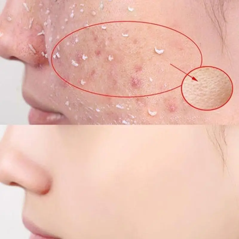 100g Natural coconut essence Exfoliating Gel Nourishing Face and Body Gentle Exfoliation Soft smooth Cleansing Skin Shrink Pore 
100g Natural coconut essence Exfoliating Gel Nourishing Face and Body Gentle Exfoliation Soft smooth Cleansing Skin Shrink Pore