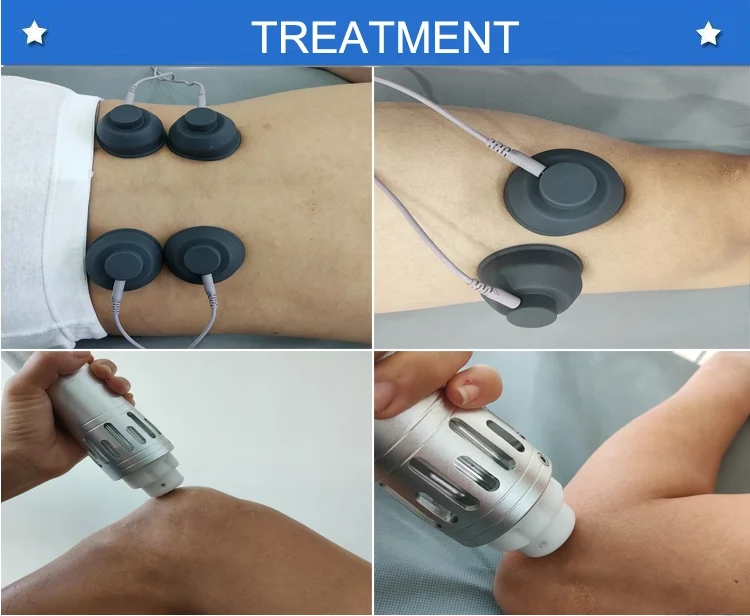 New Shock Wave Machine Shockwave Therapy Machine Extracorporeal Shock Wave Therapy Equipment Neck Shoulder Pain Relief
New Shock Wave Machine Shockwave Therapy Machine Extracorporeal Shock Wave Therapy Equipment Neck Shoulder Pain Relief
