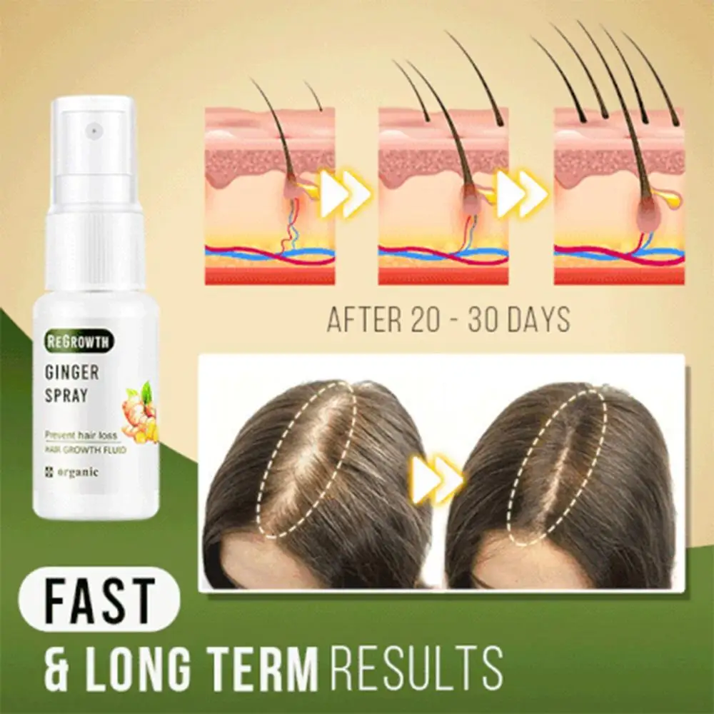 Regrowth Ginger Spray Fast Hair Growth Fluid Anti Loss Treatment Ginger Essence Prevent Hair Loss Regrowth Ginger Spray
Regrowth Ginger Spray Fast Hair Growth Fluid Anti Loss Treatment Ginger Essence Prevent Hair Loss Regrowth Ginger Spray