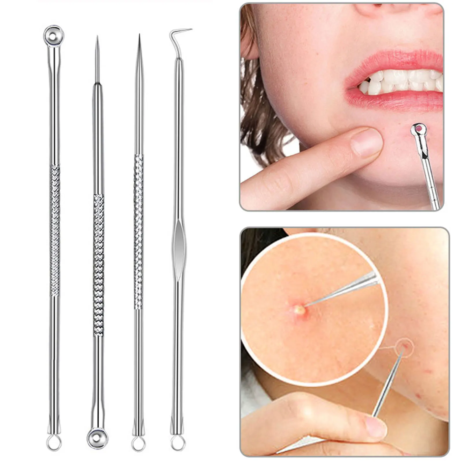 4Pcs/Set Acne Extractor Remover Tool Kit Blackhead Blemish Removers Pimple Needles Treatment Face Skin Care Tools
4Pcs/Set Acne Extractor Remover Tool Kit Blackhead Blemish Removers Pimple Needles Treatment Face Skin Care Tools