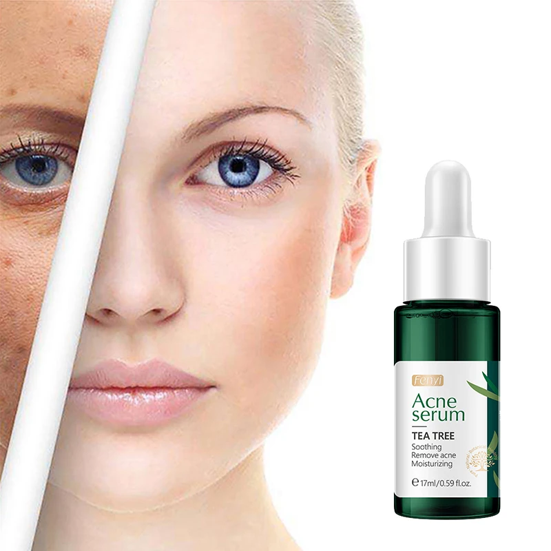 Tea Tree Essential Oil Remove Acne Face Serum Moisturizing Whitening Shrink Pores Soothing Skin Face Skin Care Essence
Tea Tree Essential Oil Remove Acne Face Serum Moisturizing Whitening Shrink Pores Soothing Skin Face Skin Care Essence