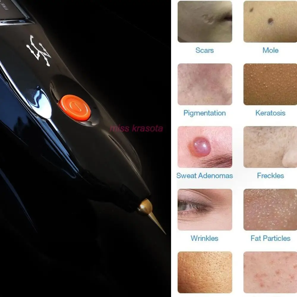 Мощная красота Монстр плазма ручка Fibroblast морщинка век Лифт пятно тату Веснушка моль ручка для удаления
Мощная красота Монстр плазма ручка Fibroblast морщинка век Лифт пятно тату Веснушка моль ручка для удаления