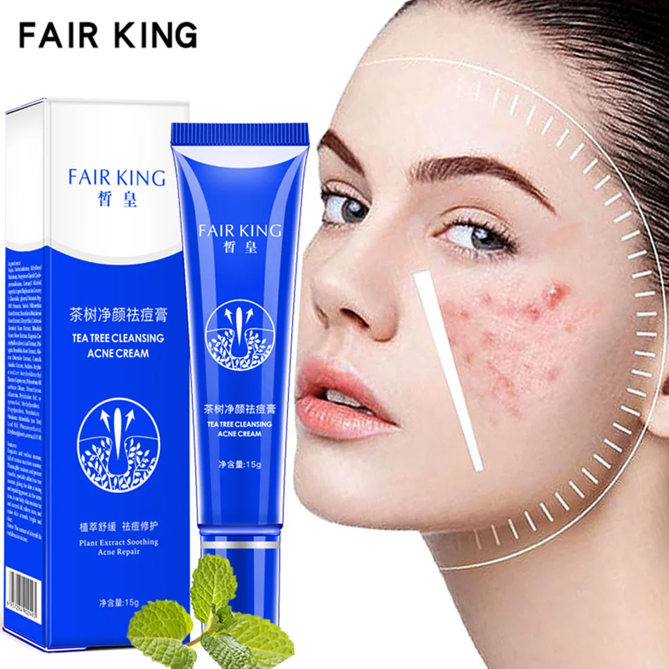 Acne Treatment Face Cream Remove Acne Scar Mark Whitening Moisturizer Oil Control Shrink Pores Cream Pigment Corrector Skin Care 
Acne Treatment Face Cream Remove Acne Scar Mark Whitening Moisturizer Oil Control Shrink Pores Cream Pigment Corrector Skin Care