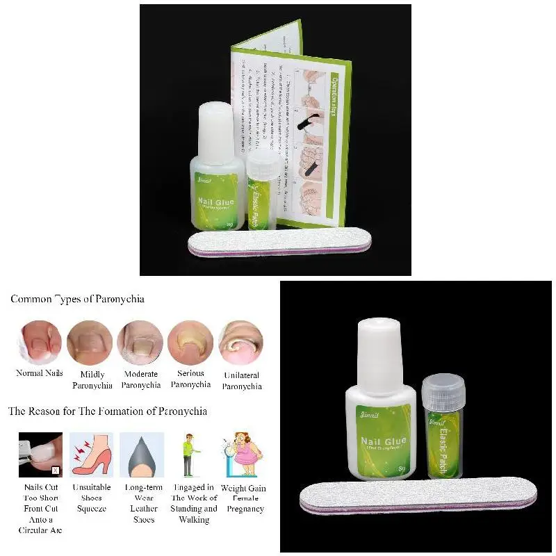 High Quality 12 Pcs/bottle of Ingrown Toenail Indent Correction Tool Nail Toe Pedicure Elastic Patch
High Quality 12 Pcs/bottle of Ingrown Toenail Indent Correction Tool Nail Toe Pedicure Elastic Patch