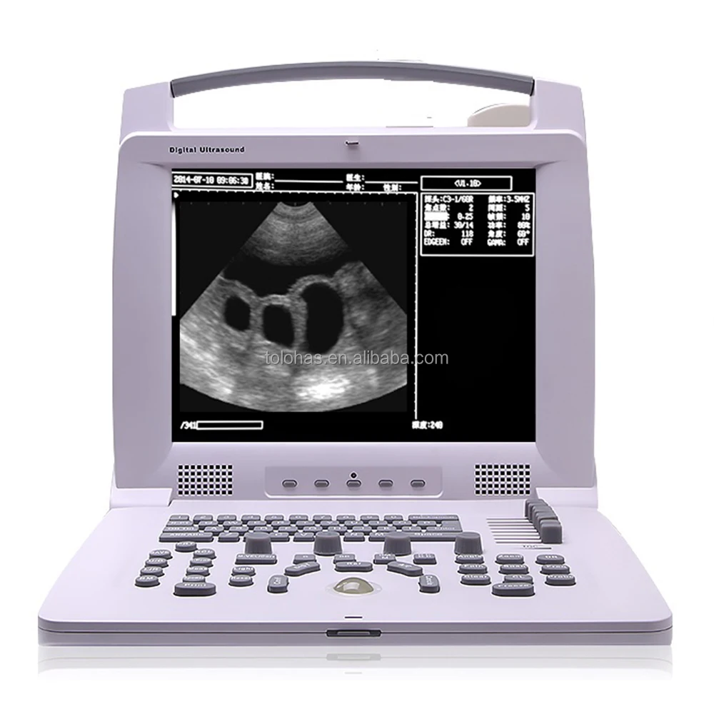 LHWPL318VP Digital Ultrasound Notebook for Animals Veterinary Equipment Animal
LHWPL318VP Digital Ultrasound Notebook for Animals Veterinary Equipment Animal