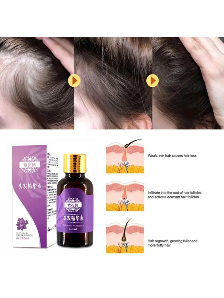 Hair Loss Products Natural With No Side Effects Grow Hair Faster Regrowth Hair Growth Products
Hair Loss Products Natural With No Side Effects Grow Hair Faster Regrowth Hair Growth Products