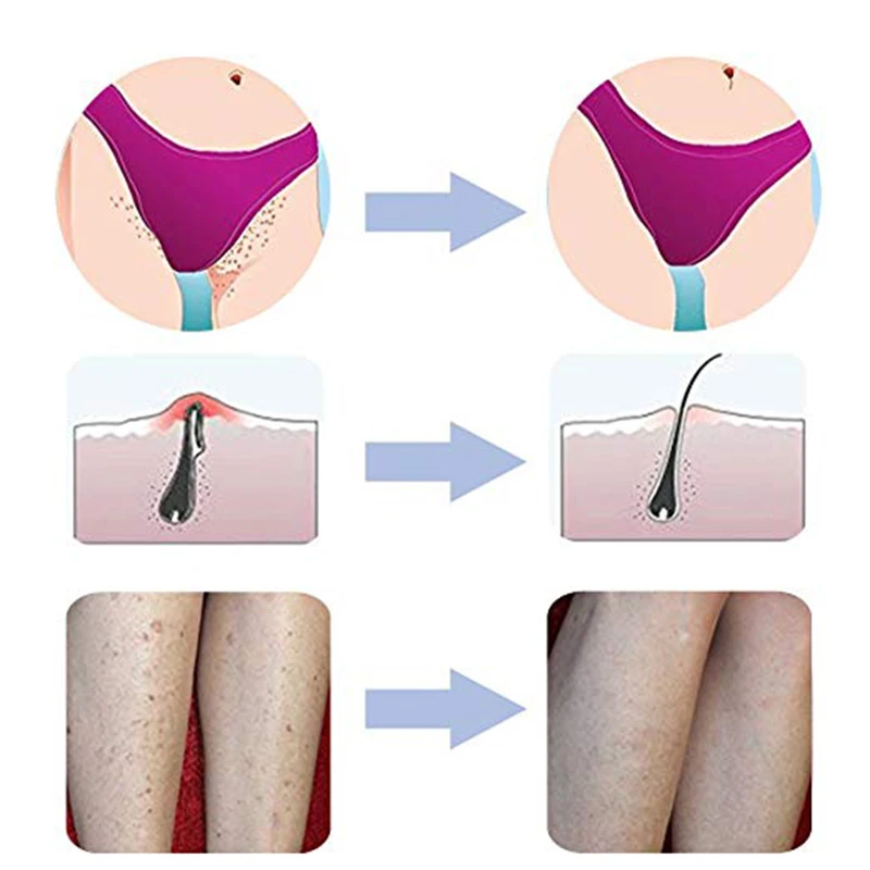 Exfoliating Brush Body Brush Eliminate Shaving Irritation For Face Neck Armpit Bikini Line Legs Prevent Razor Bumps Hair Massage
Exfoliating Brush Body Brush Eliminate Shaving Irritation For Face Neck Armpit Bikini Line Legs Prevent Razor Bumps Hair Massage