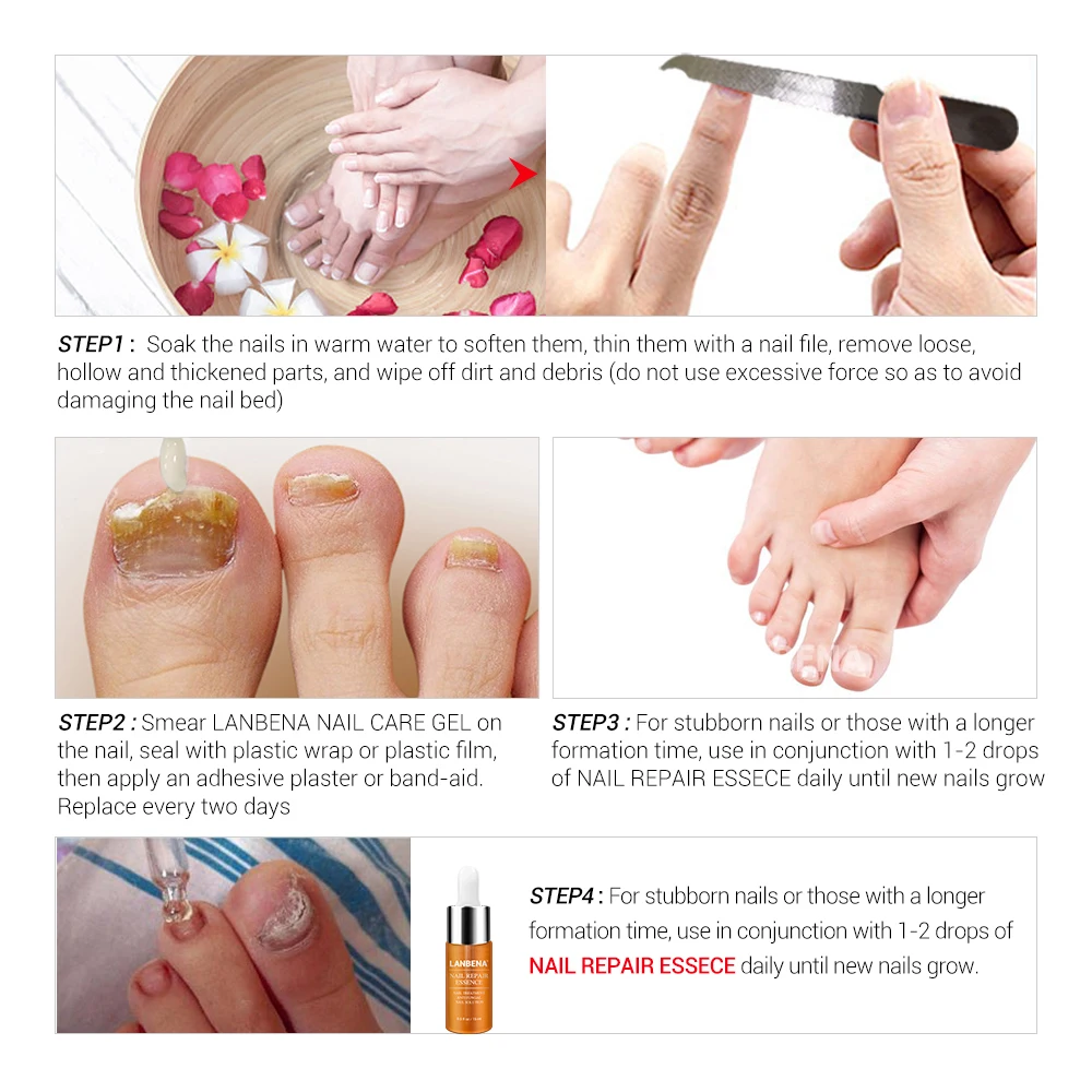 LANBENA Nail Care Gel Fungal Treatment Remove Onychomycosis Nourishing Effective Against Soften Nails Treat Hand Foot Care 20g
LANBENA Nail Care Gel Fungal Treatment Remove Onychomycosis Nourishing Effective Against Soften Nails Treat Hand Foot Care 20g