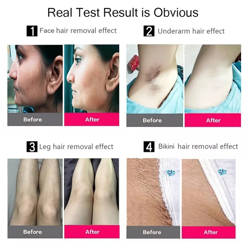 IPL Laser Hair Removal Painless Permanant Bikini Body Facial Face Hair Remover Epilator Devices 500000 Flash Laser Epilator
IPL Laser Hair Removal Painless Permanant Bikini Body Facial Face Hair Remover Epilator Devices 500000 Flash Laser Epilator