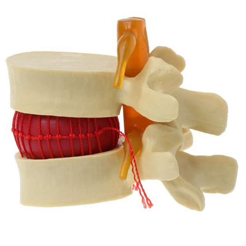 AU42 -Lumbar Vertebrae Model Anatomical Spine Lumbar Disc Herniation Anatomy Teaching Tool Lumbar Vertebrae Model
AU42 -Lumbar Vertebrae Model Anatomical Spine Lumbar Disc Herniation Anatomy Teaching Tool Lumbar Vertebrae Model