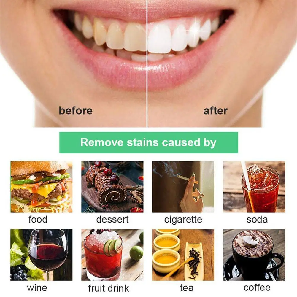 Activated Charcoal Mint Teeth Whitening Essence Powder Teeth Breath Hygiene Whiten Clean Stains Oral Oral Plaque Hy Remove P5X5
Activated Charcoal Mint Teeth Whitening Essence Powder Teeth Breath Hygiene Whiten Clean Stains Oral Oral Plaque Hy Remove P5X5