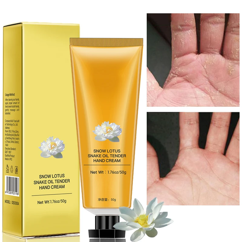 50g Snake Oil Rejuvenating Hand Moisturizing Brightening Anti-Wrinkle Cream Skin Care Whitening Cream Snow Lotus Hand Cream
50g Snake Oil Rejuvenating Hand Moisturizing Brightening Anti-Wrinkle Cream Skin Care Whitening Cream Snow Lotus Hand Cream