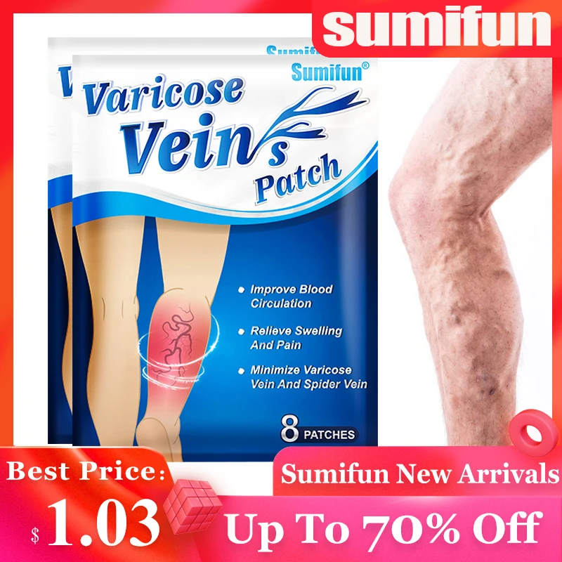 8Pcs Only$1.03 Sumifun New Varicose Veins Patch Phlebitis Vasculitis Treatment Sticker Thigh Spider Removal Pain Relief Plaster
8Pcs Only$1.03 Sumifun New Varicose Veins Patch Phlebitis Vasculitis Treatment Sticker Thigh Spider Removal Pain Relief Plaster