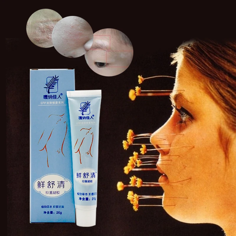 New China Herbal Bacteriostatic Gel Psoriasis Creams Body Psoriasis Dermatitis And Eczema Pruritus Psoriasis Skin Problems
New China Herbal Bacteriostatic Gel Psoriasis Creams Body Psoriasis Dermatitis And Eczema Pruritus Psoriasis Skin Problems