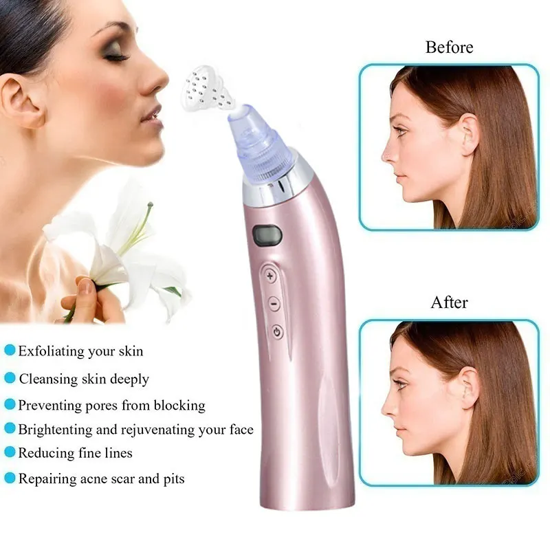 Blackhead Beauty Apparatus Effective 5 Speed Massage Clean Black Head Cleaner Remove Fast ABS Acne Blackhead Removal Apparatus
Blackhead Beauty Apparatus Effective 5 Speed Massage Clean Black Head Cleaner Remove Fast ABS Acne Blackhead Removal Apparatus
