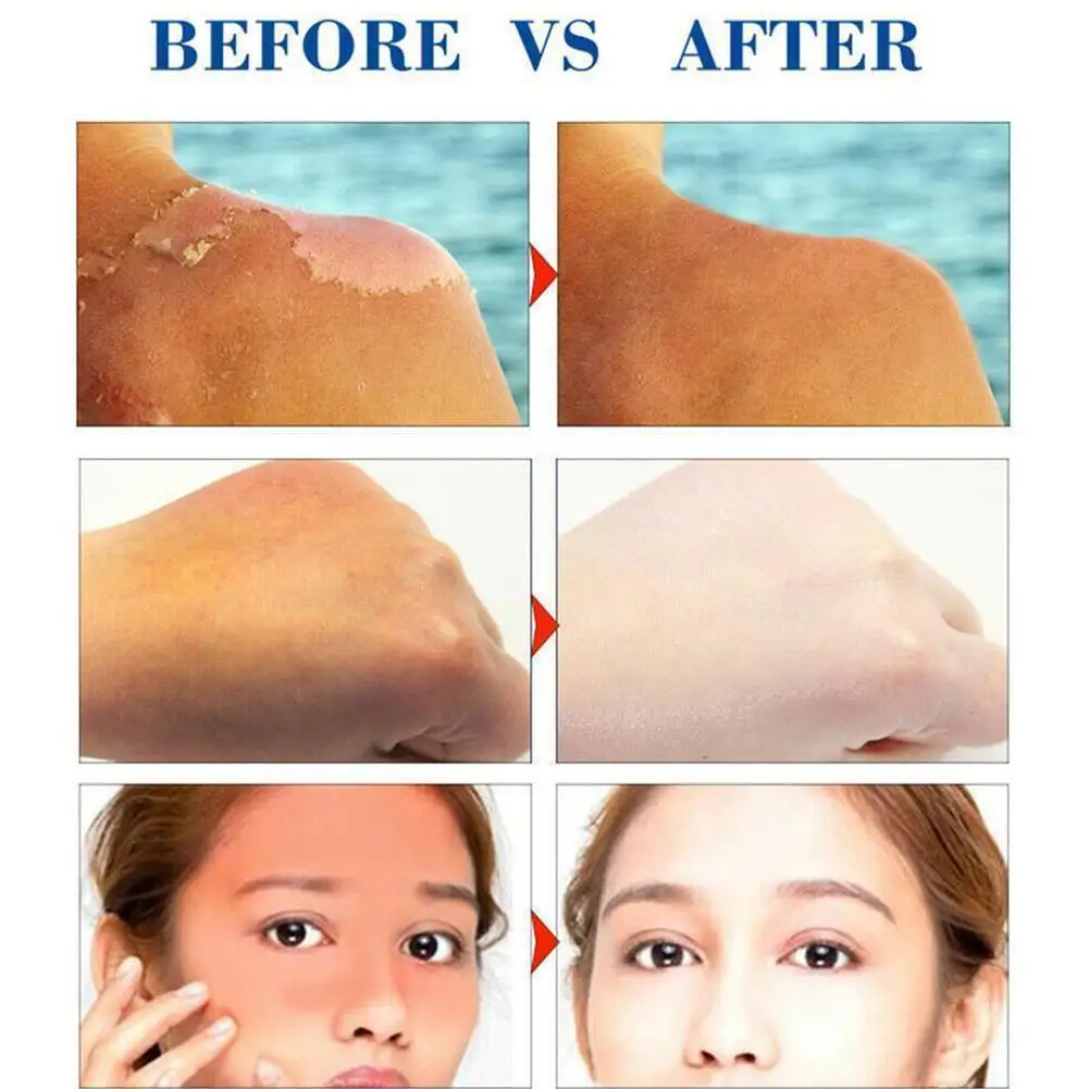 Body Sunscreen Whitening Sun Cream Sunblock Skin Protective SPF Cream Anti-Aging 90 Oil-control Moisturizing N4S5
Body Sunscreen Whitening Sun Cream Sunblock Skin Protective SPF Cream Anti-Aging 90 Oil-control Moisturizing N4S5