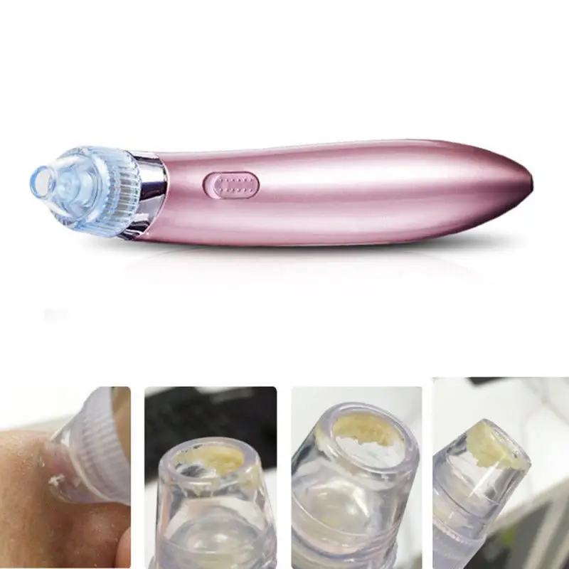 HMT Vacuum Cleaner Black Pore Electric Acne Clean Exfoliating Facial Cleaning Instrument Comedones Remove Skin Care
HMT Vacuum Cleaner Black Pore Electric Acne Clean Exfoliating Facial Cleaning Instrument Comedones Remove Skin Care