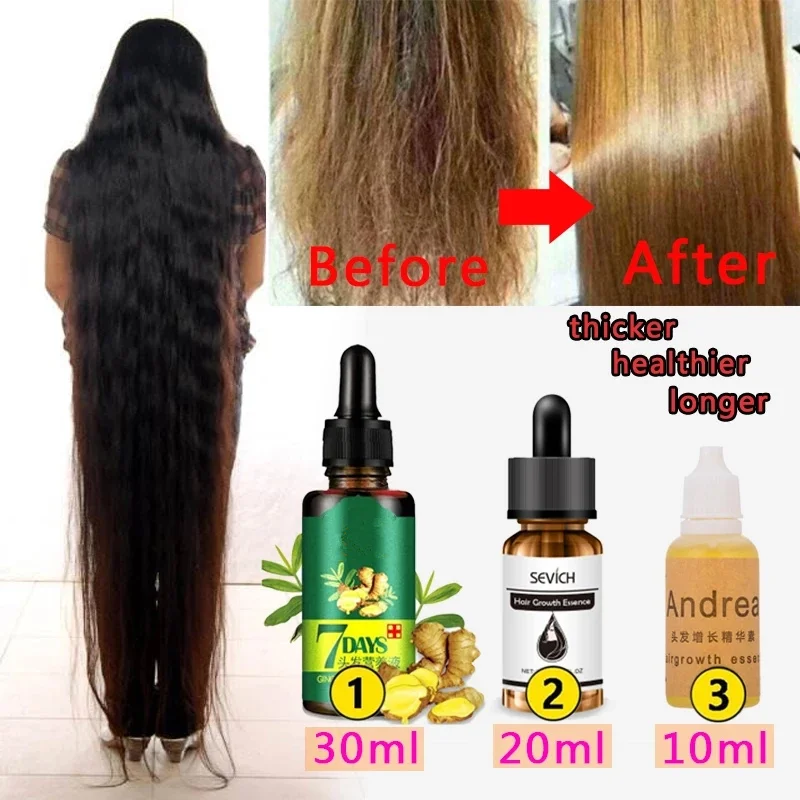 30/20/10 ML Effective Hair Growth Essence Loss Treatment Scalp Repair Essence Men Women Hair Extension Oil Hair Care Products
30/20/10 ML Effective Hair Growth Essence Loss Treatment Scalp Repair Essence Men Women Hair Extension Oil Hair Care Products