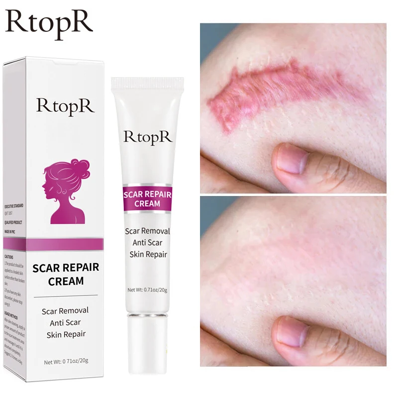 Scar Removal Face Cream Repairing Stretch Marks Surgical Scar Skin Care Promote Cell Regeneration Enhance Elasticity Beauty Care
Scar Removal Face Cream Repairing Stretch Marks Surgical Scar Skin Care Promote Cell Regeneration Enhance Elasticity Beauty Care