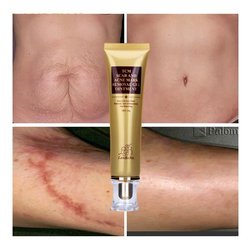 Acne Scar Removal Cream Skin Repair Face Cream Acne Spots Acne Treatment Blackhead Whitening Cream Stretch Marks 30ml
Acne Scar Removal Cream Skin Repair Face Cream Acne Spots Acne Treatment Blackhead Whitening Cream Stretch Marks 30ml