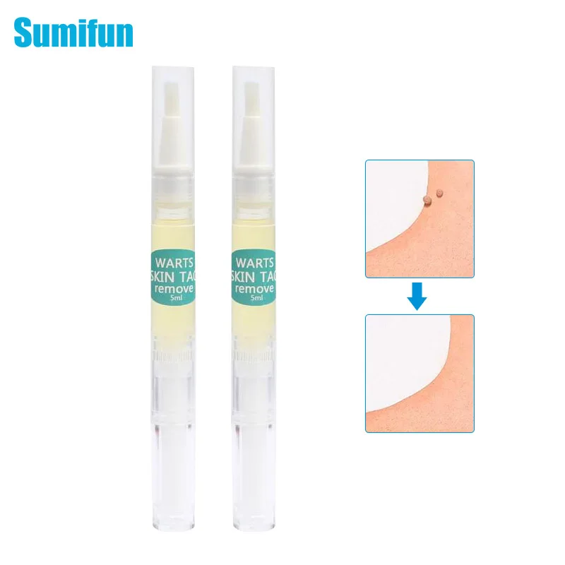 1Pcs 5 ml Skin Tag Pen Wart Liquid Against Genital Wart Flat Warts Painless Rapidly Removes Removal Papillomas Skin Care 
1Pcs 5 ml Skin Tag Pen Wart Liquid Against Genital Wart Flat Warts Painless Rapidly Removes Removal Papillomas Skin Care