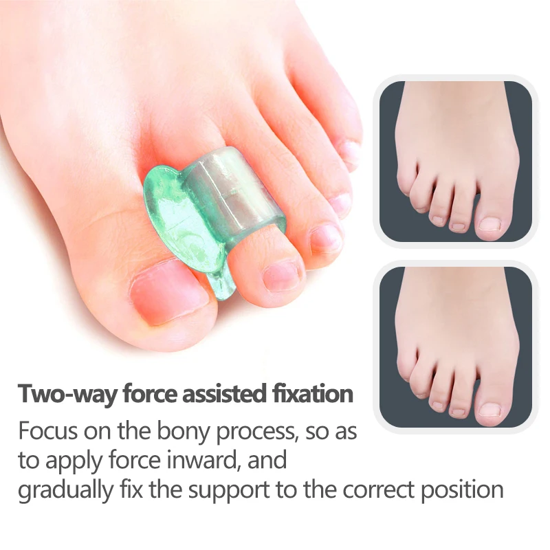 2pcs Sumifun Green Soft Silicone Gel Toe Separator Hallux Valgus Bunion Spacers Thumb Corrector Foot Health Care Tools C1956 
2pcs Sumifun Green Soft Silicone Gel Toe Separator Hallux Valgus Bunion Spacers Thumb Corrector Foot Health Care Tools C1956