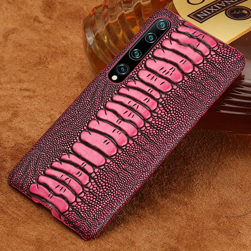 Чехол из натуральной кожи для Mi 12T 12S Ultra 12 11 Lite Poco X3 X4 Pro F3 F4 GT, чехол для Xiaomi Redmi Note 11 10 9 8 Pro 11S
Чехол из натуральной кожи для Mi 12T 12S Ultra 12 11 Lite Poco X3 X4 Pro F3 F4 GT, чехол для Xiaomi Redmi Note 11 10 9 8 Pro 11S