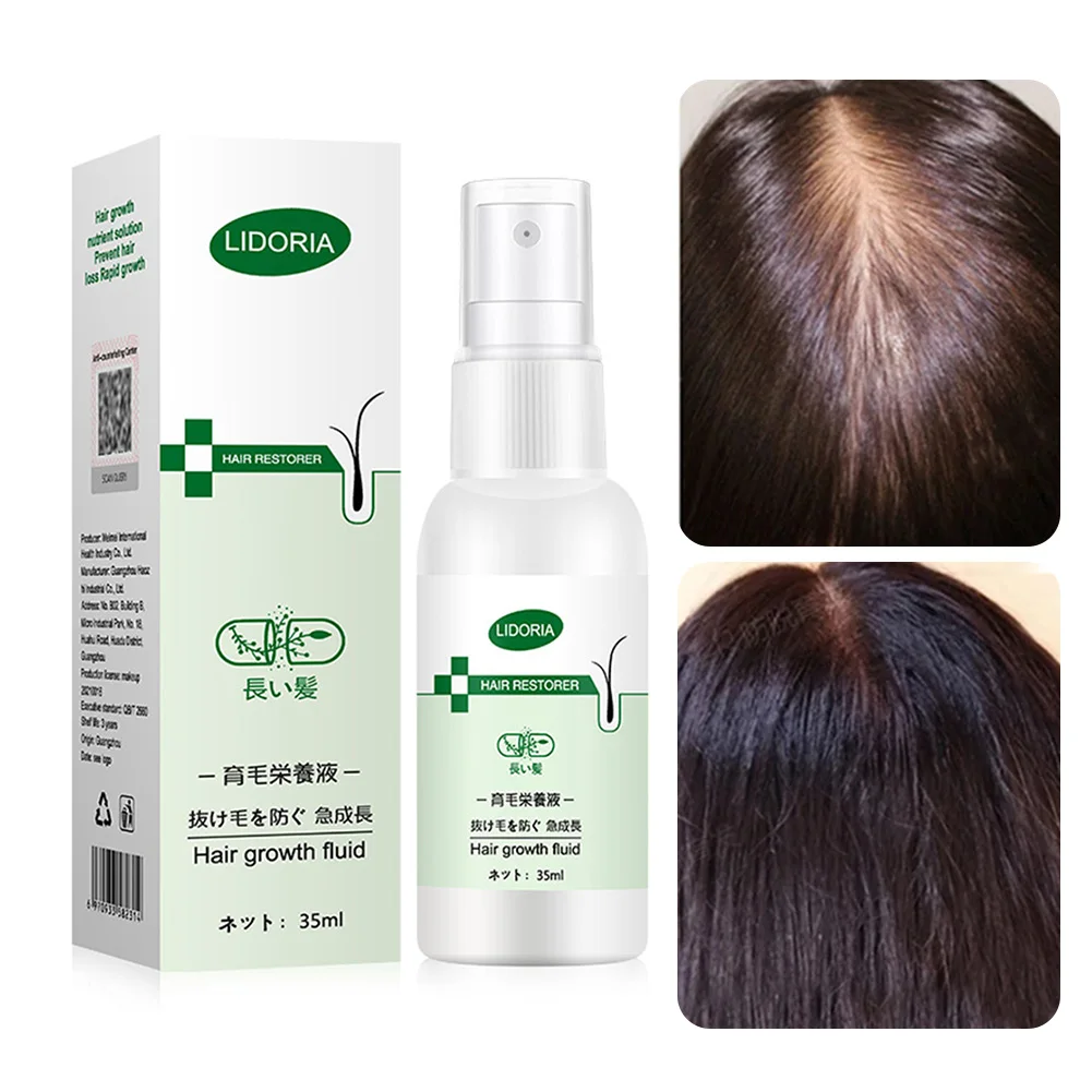 35ml Hair Growth Spray Natural Herbal Hair Serum Hair Loss Preventation Dry Damaged Repair Spray Hair Care
35ml Hair Growth Spray Natural Herbal Hair Serum Hair Loss Preventation Dry Damaged Repair Spray Hair Care