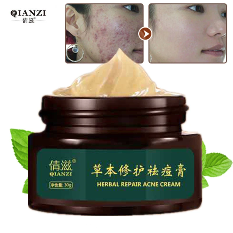 Herbal Acne Cream Anti Pimple Spot Acne Scars Blackhead Removal Cream Whitening Beauty Skin Face Care Creams Acne Treament
Herbal Acne Cream Anti Pimple Spot Acne Scars Blackhead Removal Cream Whitening Beauty Skin Face Care Creams Acne Treament