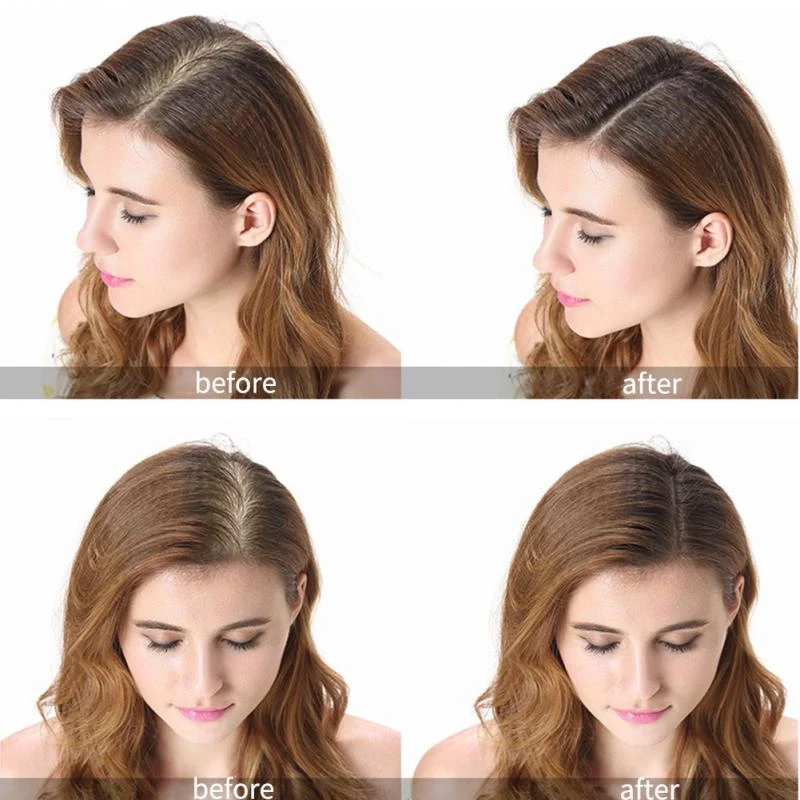 2PCS/Set Plenty Lossing Hair Treatment Thickening Hair Shampoo Conditioner Set Enhance for Hair Regrowth Gift Set
2PCS/Set Plenty Lossing Hair Treatment Thickening Hair Shampoo Conditioner Set Enhance for Hair Regrowth Gift Set