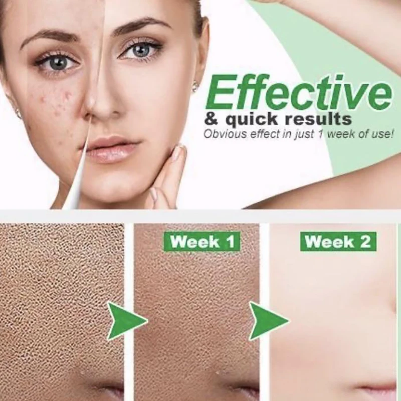 Belay Zeropore Instant Perfection Serum Lactobionic Acid Face Solution Minimize Pores Remover Wrinkle Lift Firming Essence | Красота и