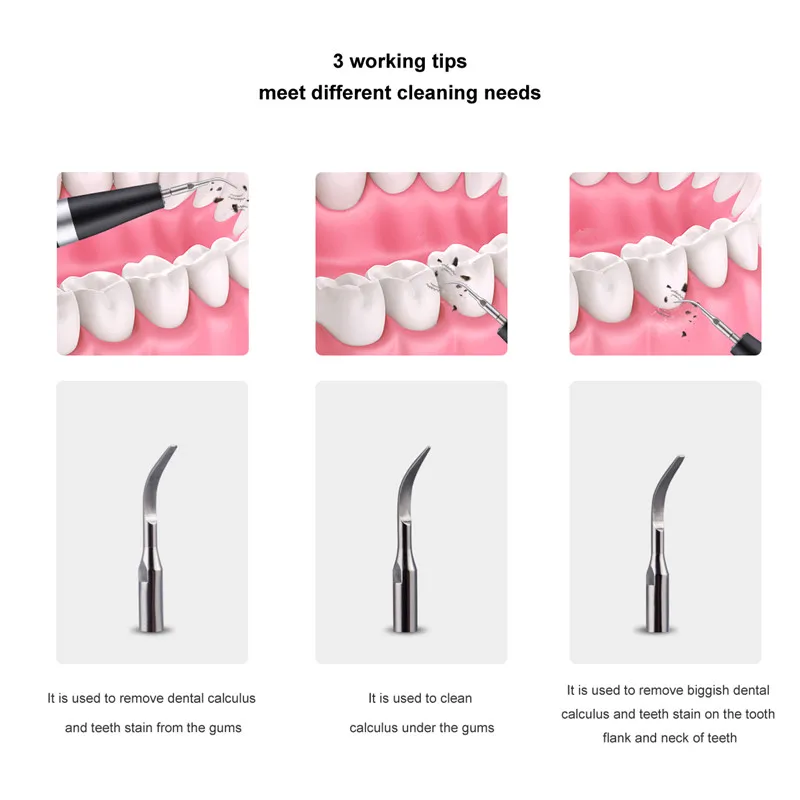 CkeyiN Electric Pulse Wave Ion Sonic Dental Scaler 5 Modes Calculus Remover Led Light Smoke Stains Tartar Plaque Removal Teeth
CkeyiN Electric Pulse Wave Ion Sonic Dental Scaler 5 Modes Calculus Remover Led Light Smoke Stains Tartar Plaque Removal Teeth