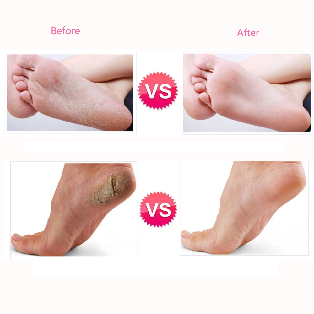 Electric Pedicure Tools Foot Care File Leg Heels Remove Dead Skin Callus Remover Feet Clean Care Machine & Replacement Sandpaper
Electric Pedicure Tools Foot Care File Leg Heels Remove Dead Skin Callus Remover Feet Clean Care Machine & Replacement Sandpaper