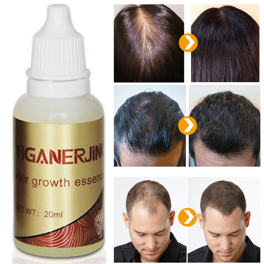 Anti Loss Dry Repair Anti-alopecia Useful Hair Growth Essence Moisturizing Scalp Nurishing
Anti Loss Dry Repair Anti-alopecia Useful Hair Growth Essence Moisturizing Scalp Nurishing