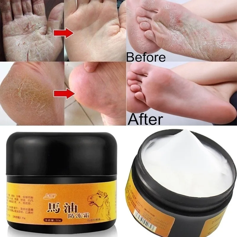 Horse Oil Foot Hand Antifreeze Cream Treatment Dry Skin Heel Chapped Peeling Repair Anti Chapping Wrinkle Treatment Ointment
Horse Oil Foot Hand Antifreeze Cream Treatment Dry Skin Heel Chapped Peeling Repair Anti Chapping Wrinkle Treatment Ointment