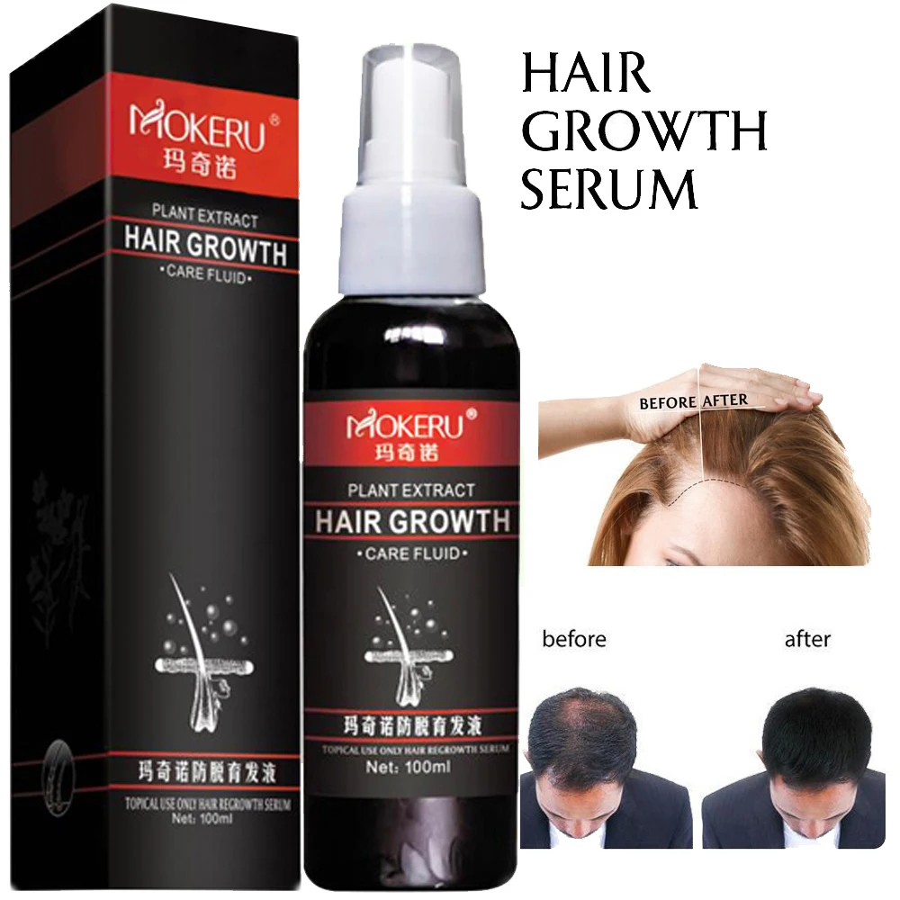 Mokeru 100ml Natural Ginger Essence Anti Hair Loss Products Spray Hair Regrowth Oil for Hair Growth Products Woman Man Care
Mokeru 100ml Natural Ginger Essence Anti Hair Loss Products Spray Hair Regrowth Oil for Hair Growth Products Woman Man Care