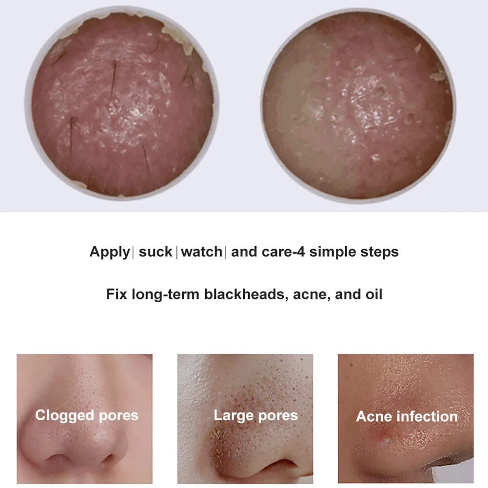 Heating Blackhead Remover Pore Vacuum Cleaner For Nose Face Skin Acne Sucker Rechargeable LCD Display Suction Spot Removal Tools
Heating Blackhead Remover Pore Vacuum Cleaner For Nose Face Skin Acne Sucker Rechargeable LCD Display Suction Spot Removal Tools