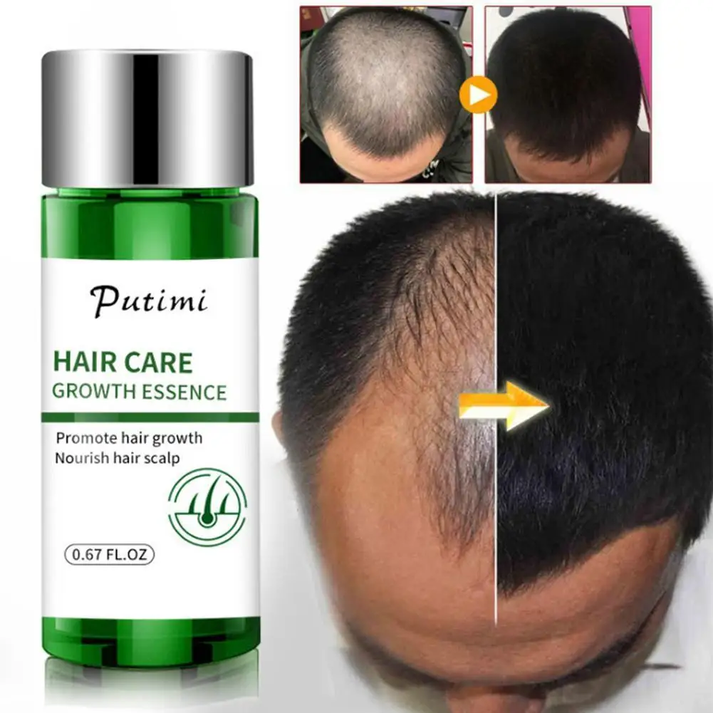

Эфирные масла для роста волос, эссенция для восстановления волос, против облысения, выпадения волос, сыворотка для ухода за волосами, 20 мл