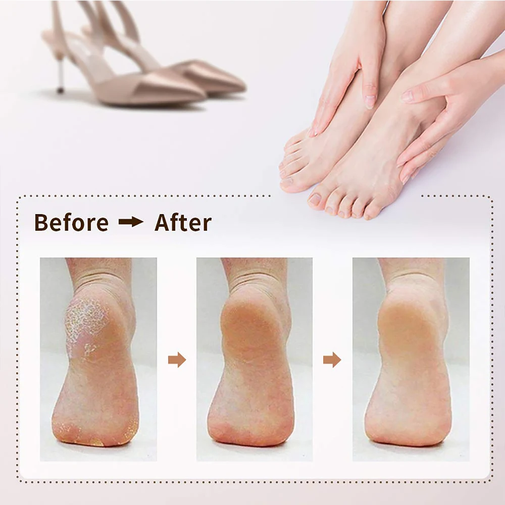 Electric Sawing Foot File USB Charging Feet Pedicure Machine Digital Display Foot care Tool Dead Skin Roller Electric Foot File
Electric Sawing Foot File USB Charging Feet Pedicure Machine Digital Display Foot care Tool Dead Skin Roller Electric Foot File